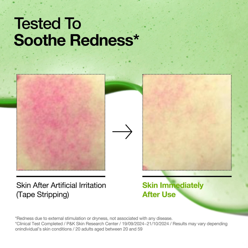 Anua - Azelaic Acid 10 Hyaluron Redness Soothing Serum 30ml